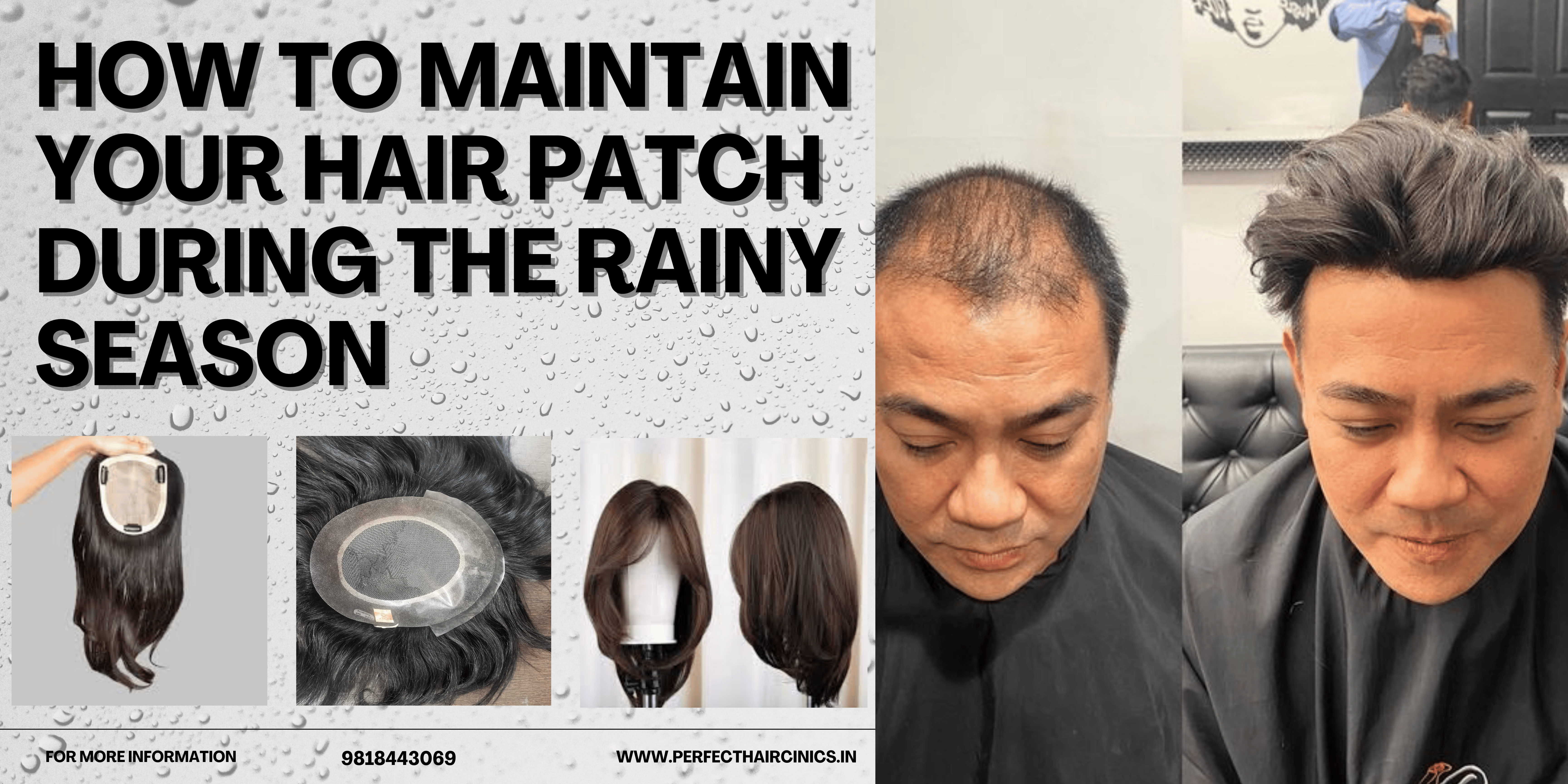 How to Maintain Your Hair Patch During the Rainy Season