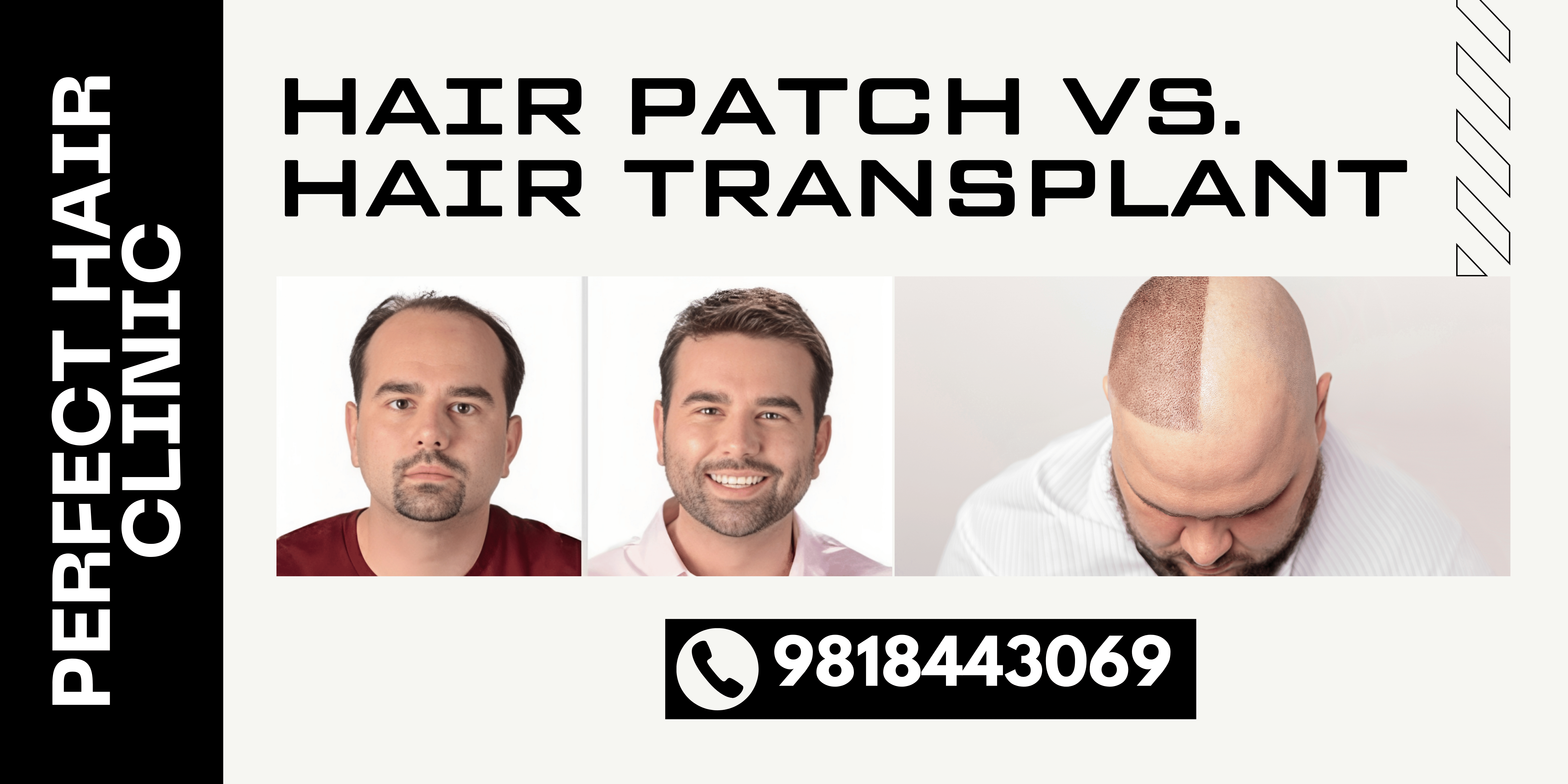 Hair Patch Service 