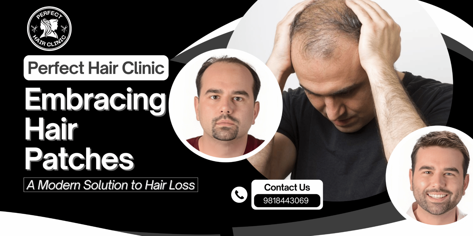 Hair Patch in Delhi Hair patch in lajpat Nagar