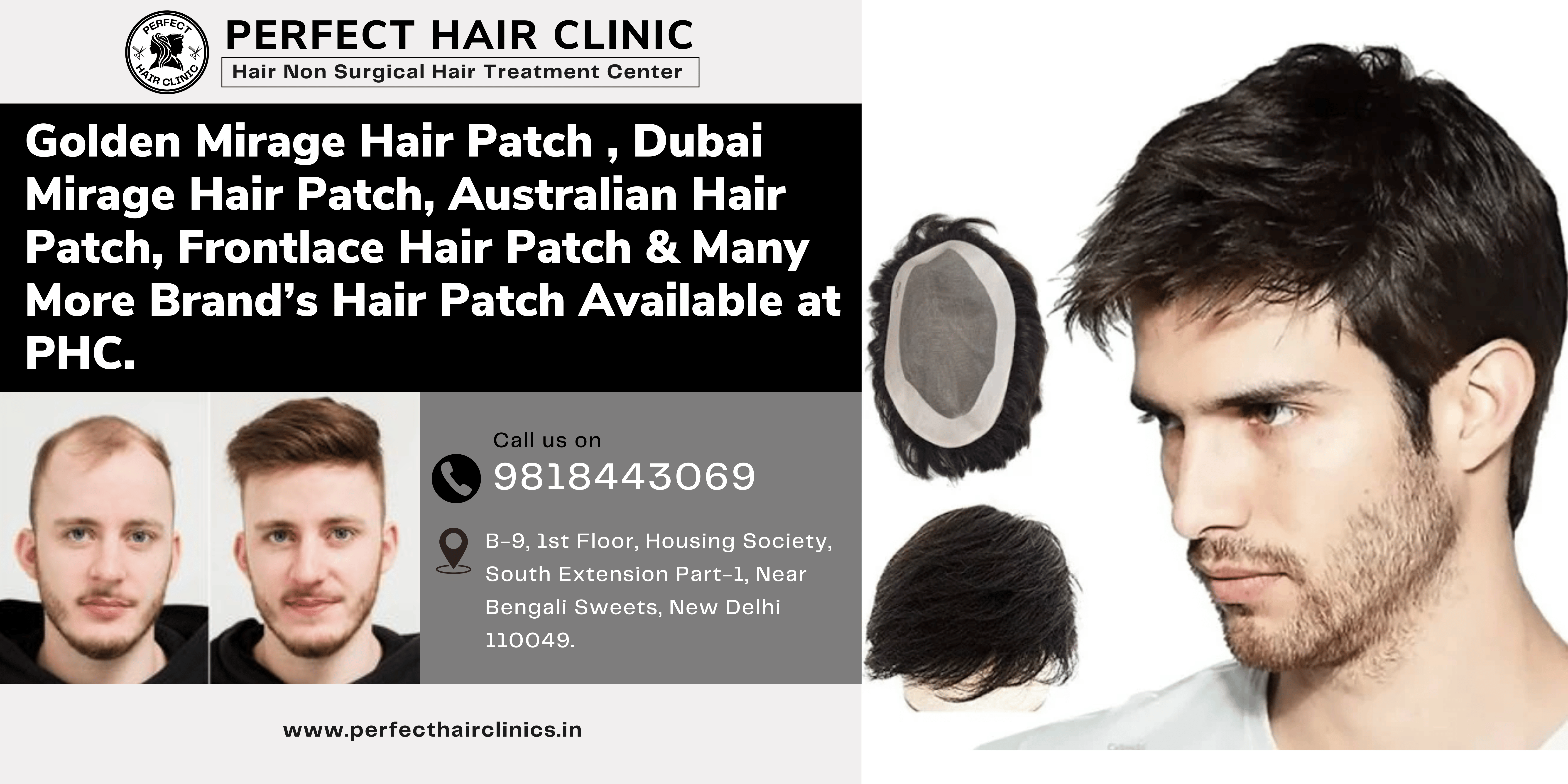 Exploring Mirage, Dubai, and Australian Hair Patches: Your Guide to International Hair Patch Solutions