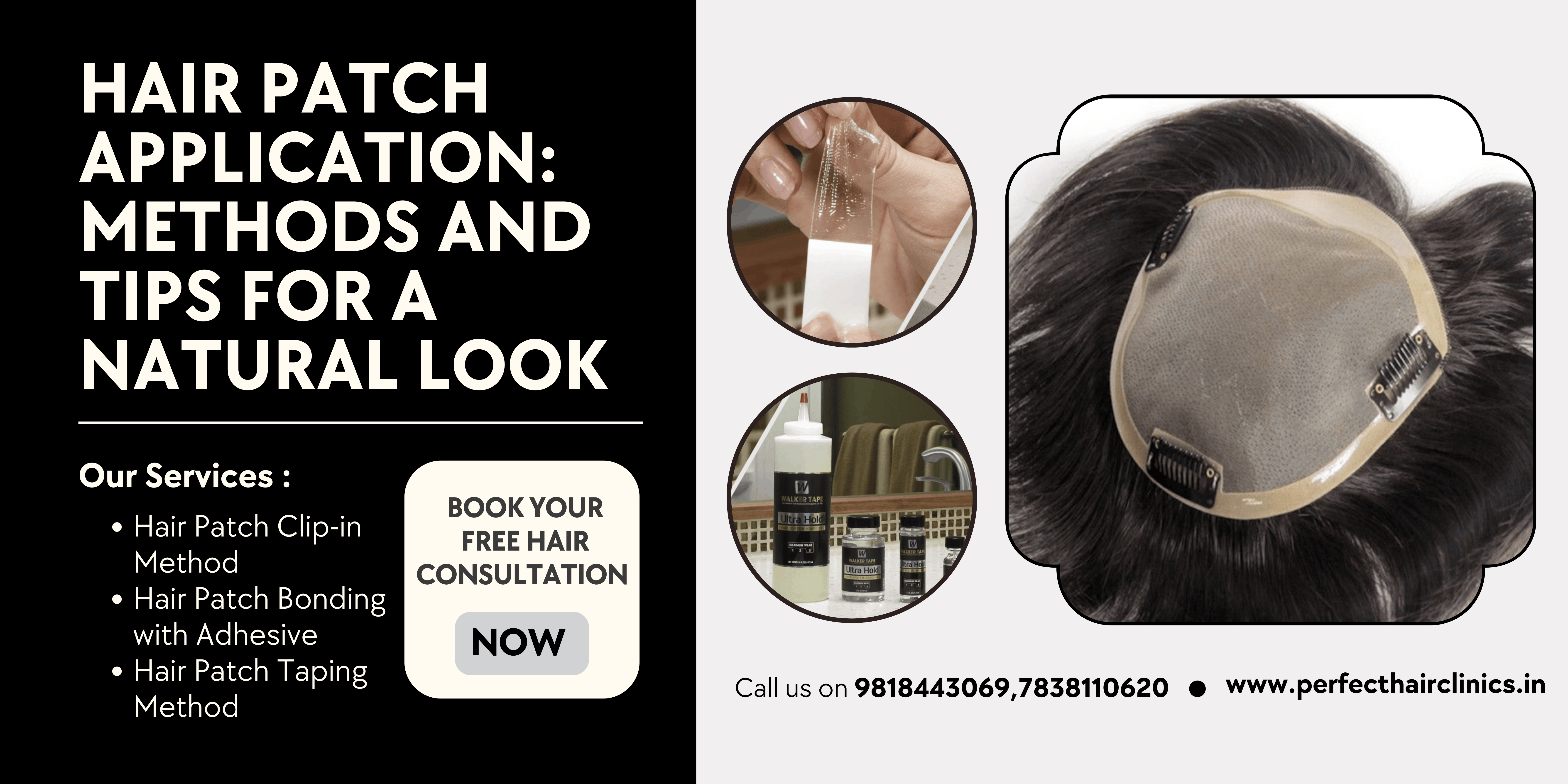 Best Hair Loss Solution in Delhi 