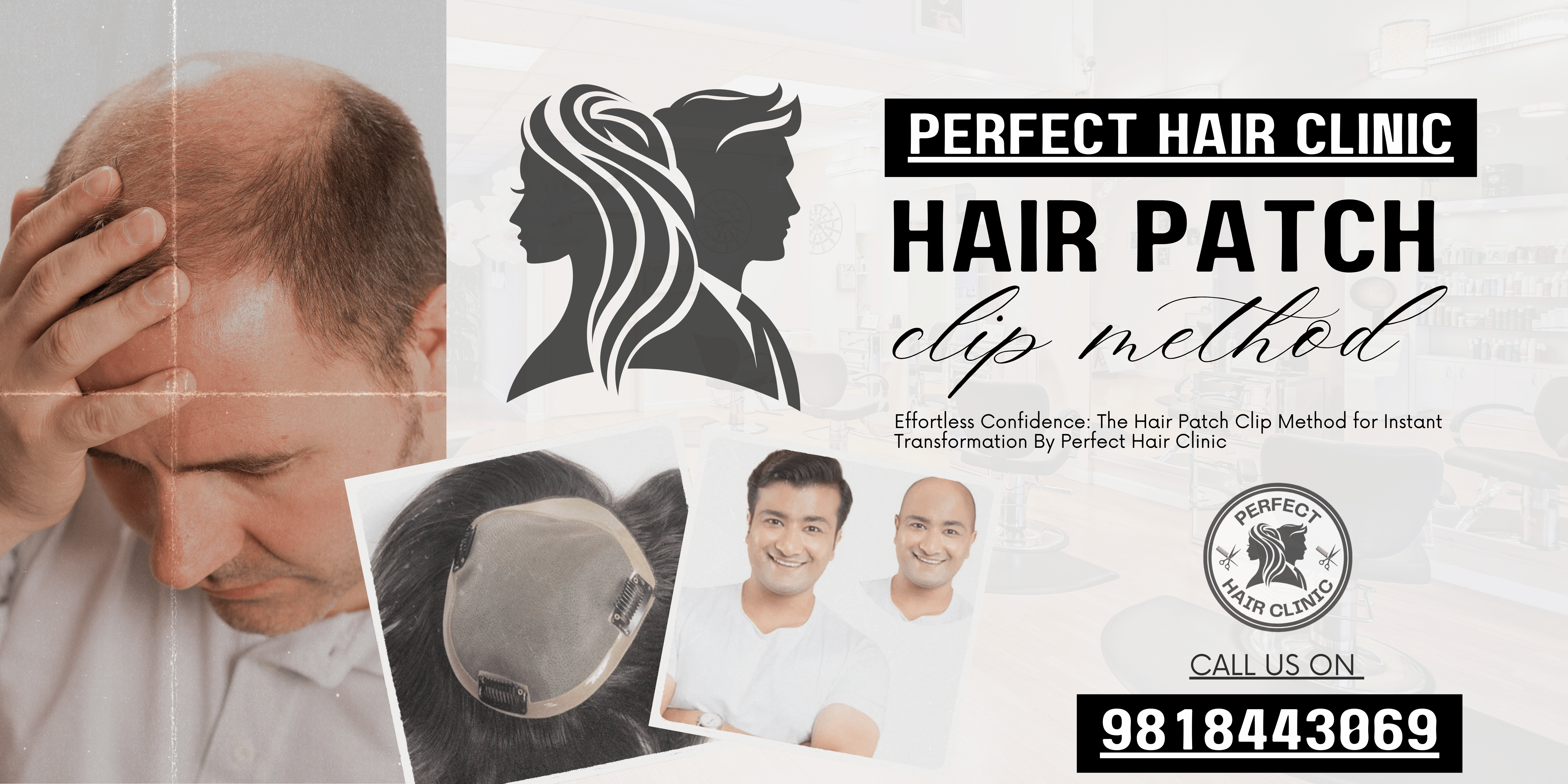 Best hair patch fixing in delhi