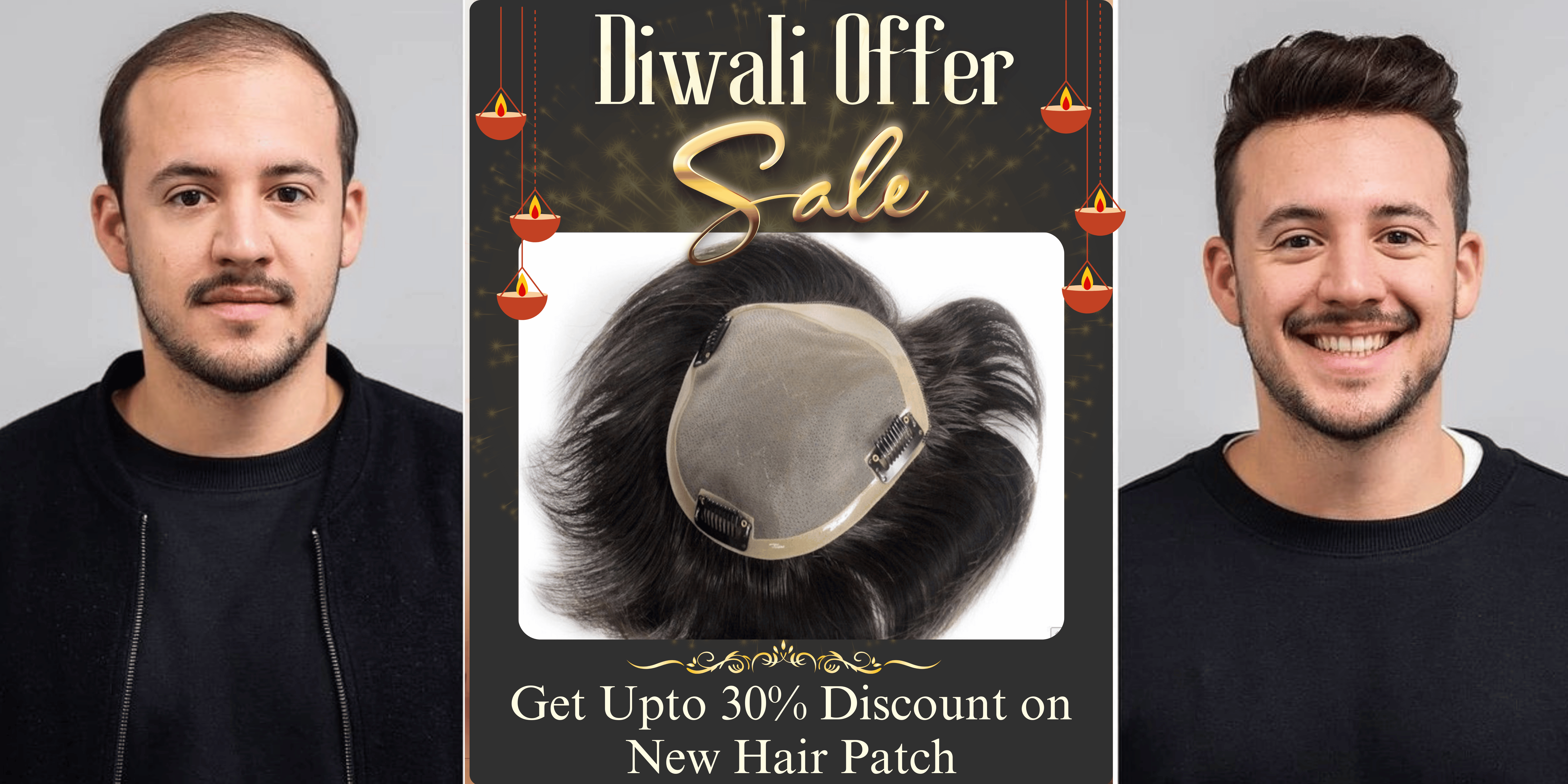 diwali offer on hair patch