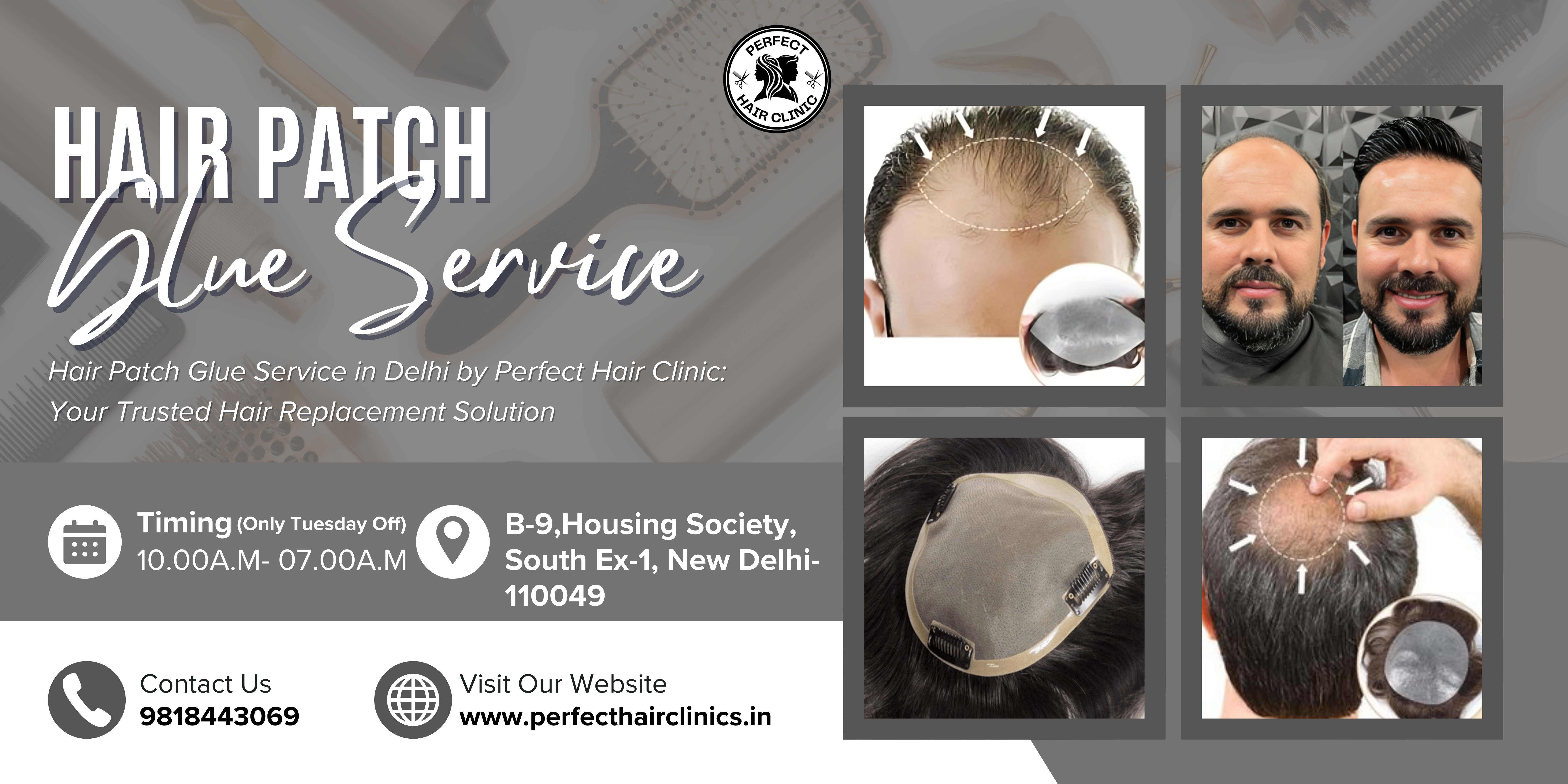 hair patch in South Delhi
Best Hair Patch Service in Delhi