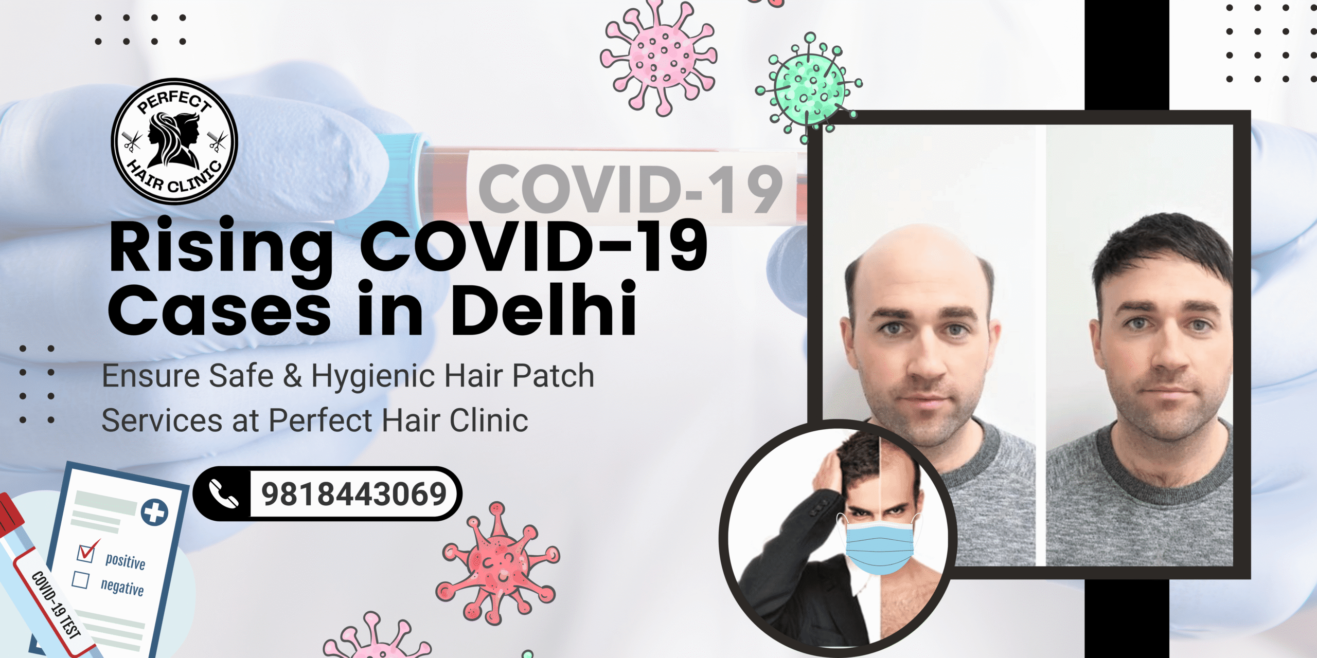 Best hair patch fixing in south delhi