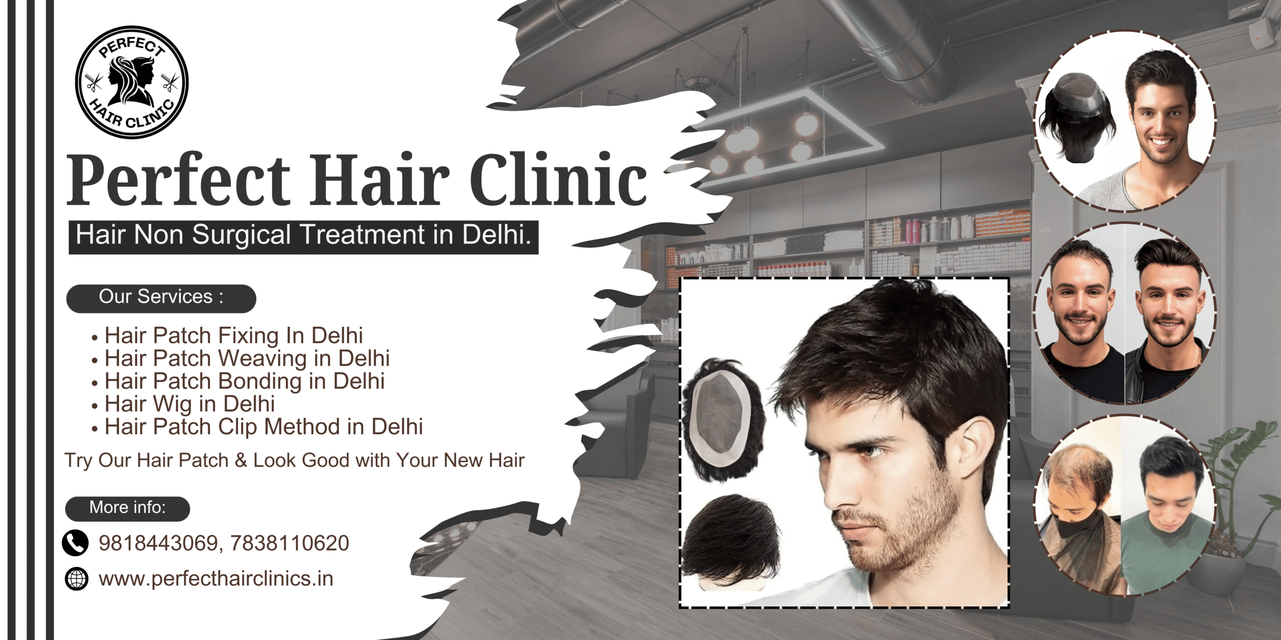 Best hair Patch Service in Delhi