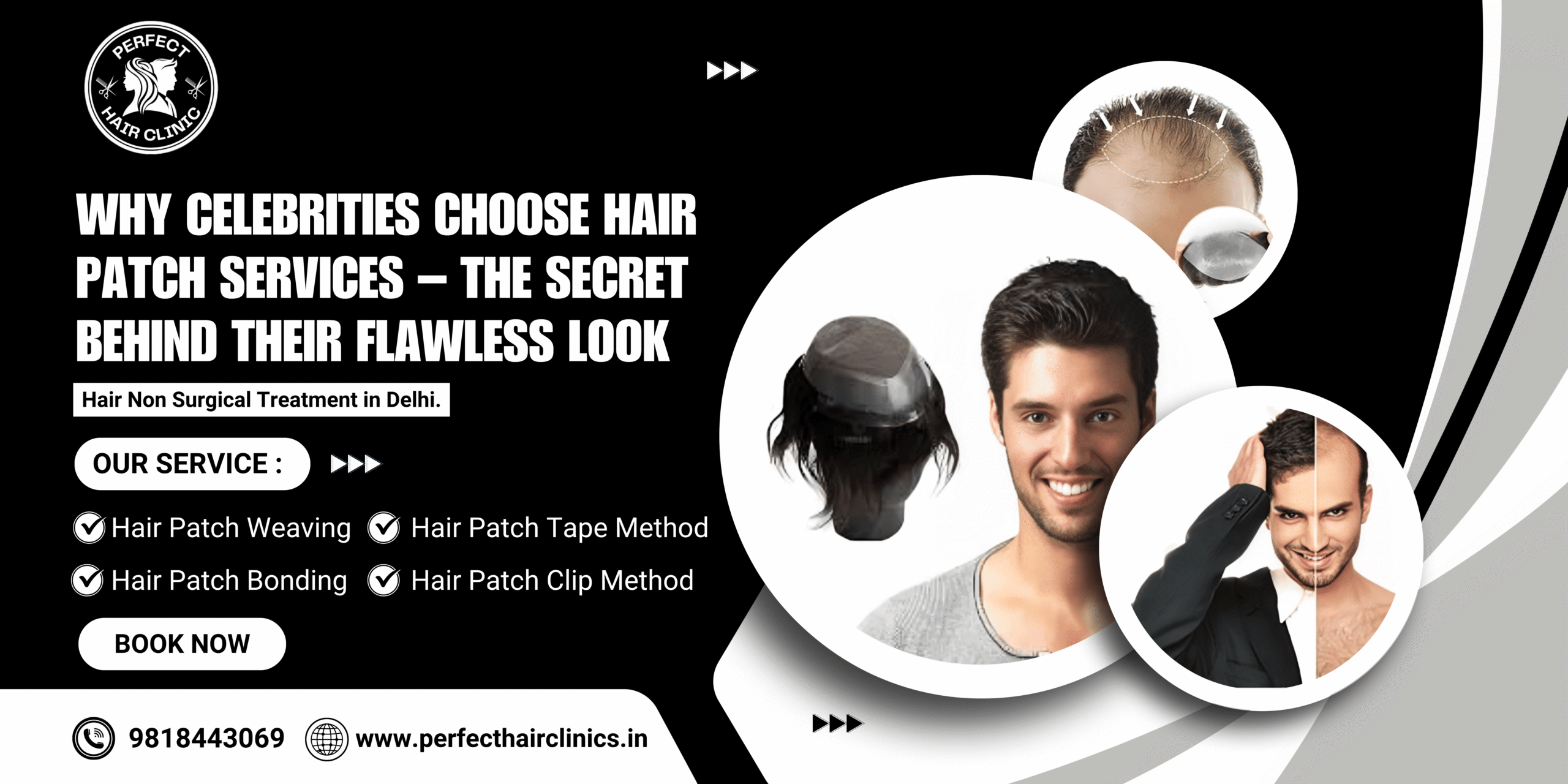 best hair patch service for celebrity