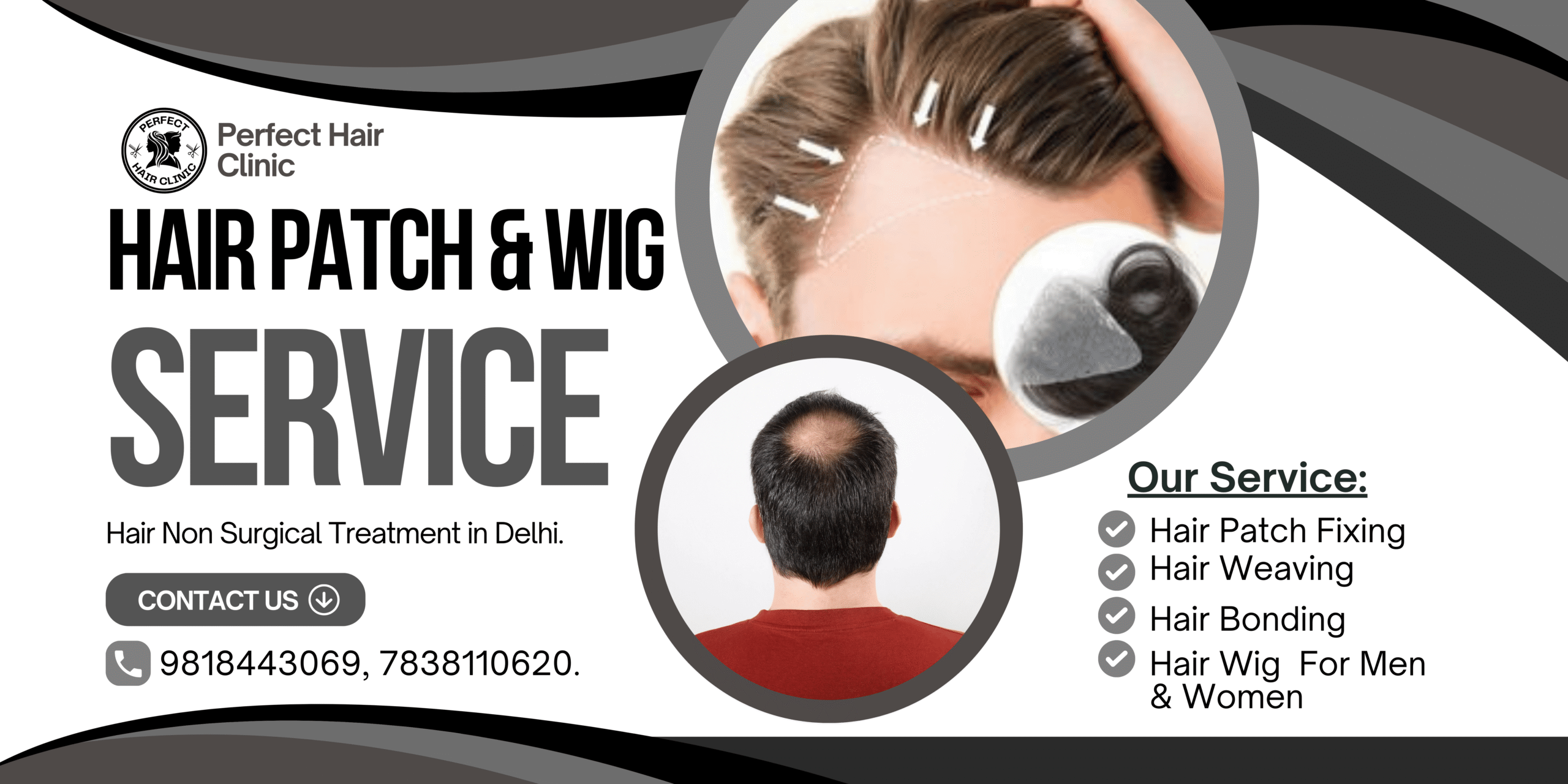 Hair fixing near me Delhi, Hair patch service in South Delhi, Best hair wig center in Delhi NCR, Best non-surgical hair restoration clinic near me, Hair patch with glue service Delhi, Hair patch for cancer patients India, Perfect Hair Clinic best hair patch in Delhi, complete hair solution hair patch fixing, hair patch fixing near me, hair patch fixing gum, hair patch fixing glue, hair patch fixing in delhi, how to fix a patch in your hair, how long do hair patch last, hair patch border repair, hair patch fixing centre, hair patch fixing cost, hair patch filling, hair patch maintenance, wash hair patch, how to fix hair patch with clip